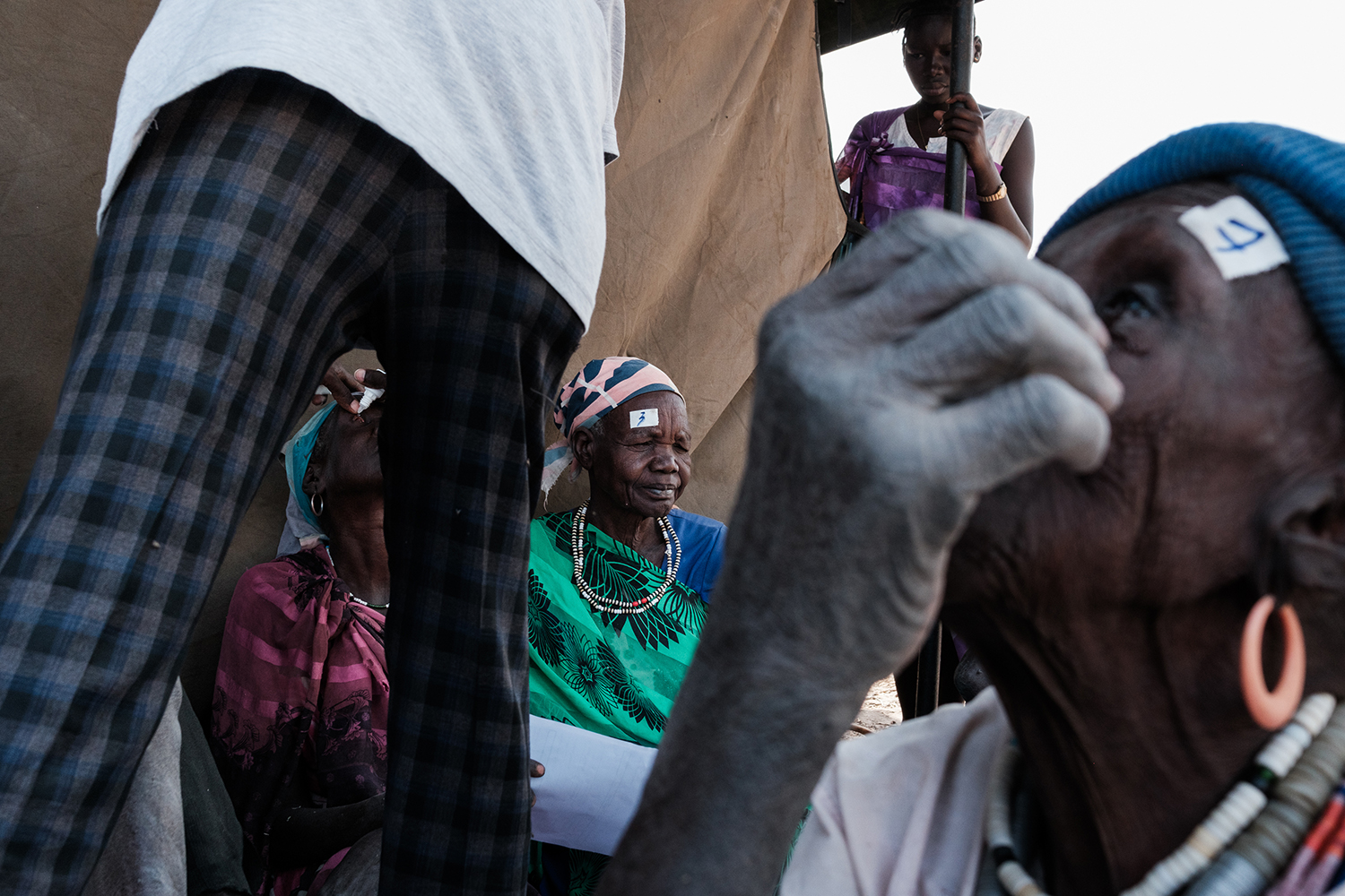 South Sudan's first female eye surgeon leads the way to eliminating Trachoma through remote surgery