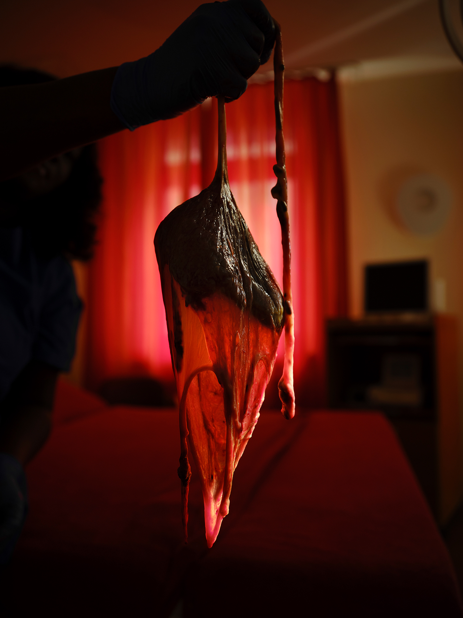 4 - Placenta - 11605b6e-ca58-47c8-9593-7bf29c790332.jpg